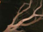 tree 1 levels