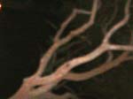 tree 1 levels